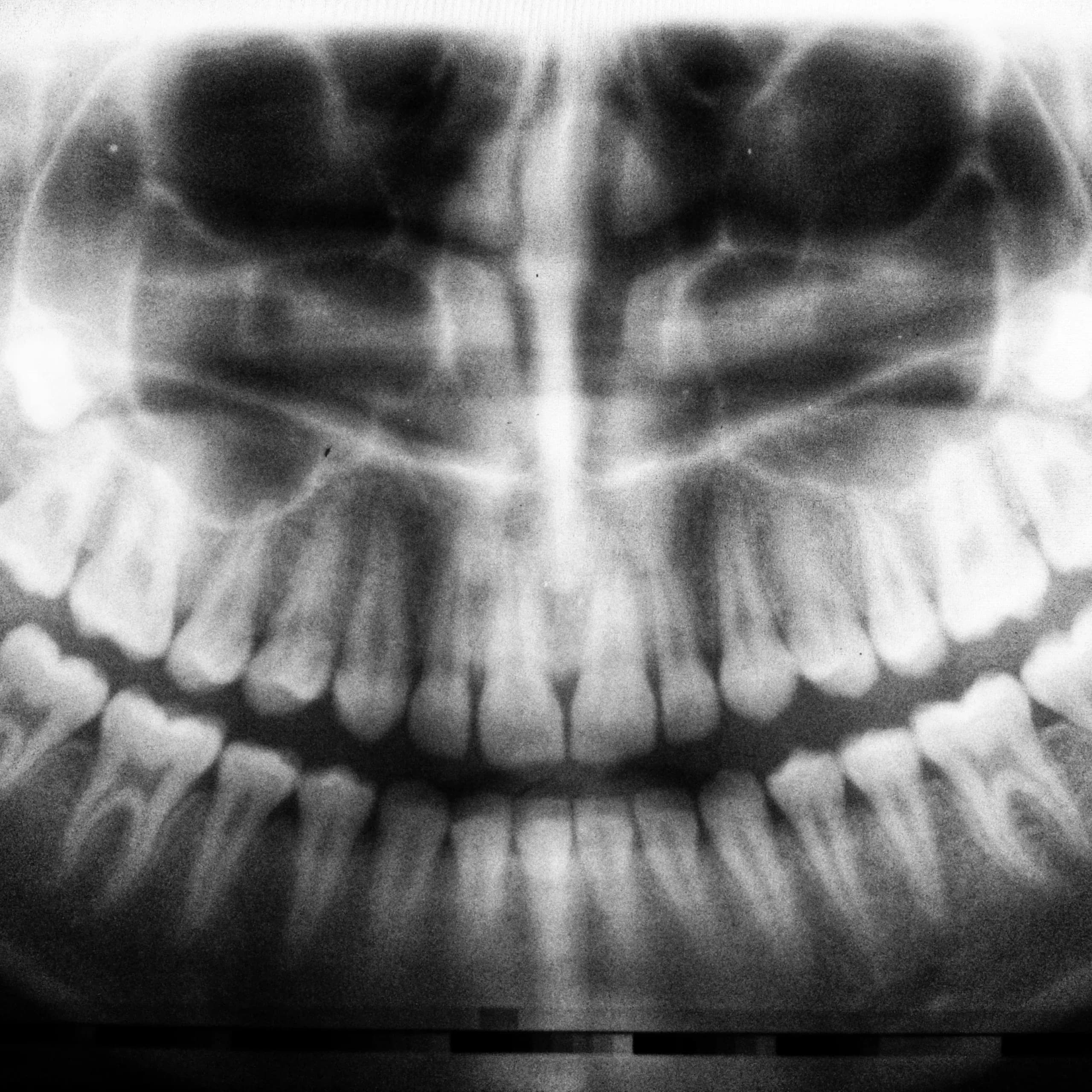 Oral and Dental Health: Daily Care Tips and Essential Advice