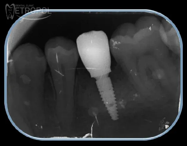 Oral & Maxillofacial Surgery
