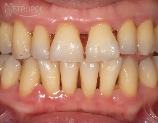 Periodontics