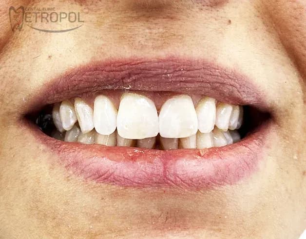 Restorative Dentistry